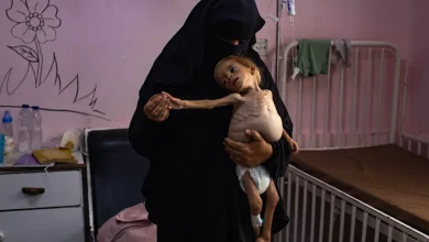 Gaza Starvation: The Untold Truth of a Modern Crisis
