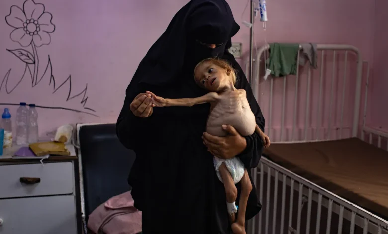 Gaza Starvation: The Untold Truth of a Modern Crisis Gaza Starvation: The Untold Truth of a Modern Crisis